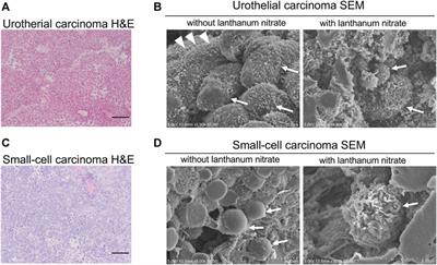 Glycocalyx analysis of bladder cancer: three-dimensional images in electron microscopy and vicia villosa lectin as a marker for invasiveness in frozen sections